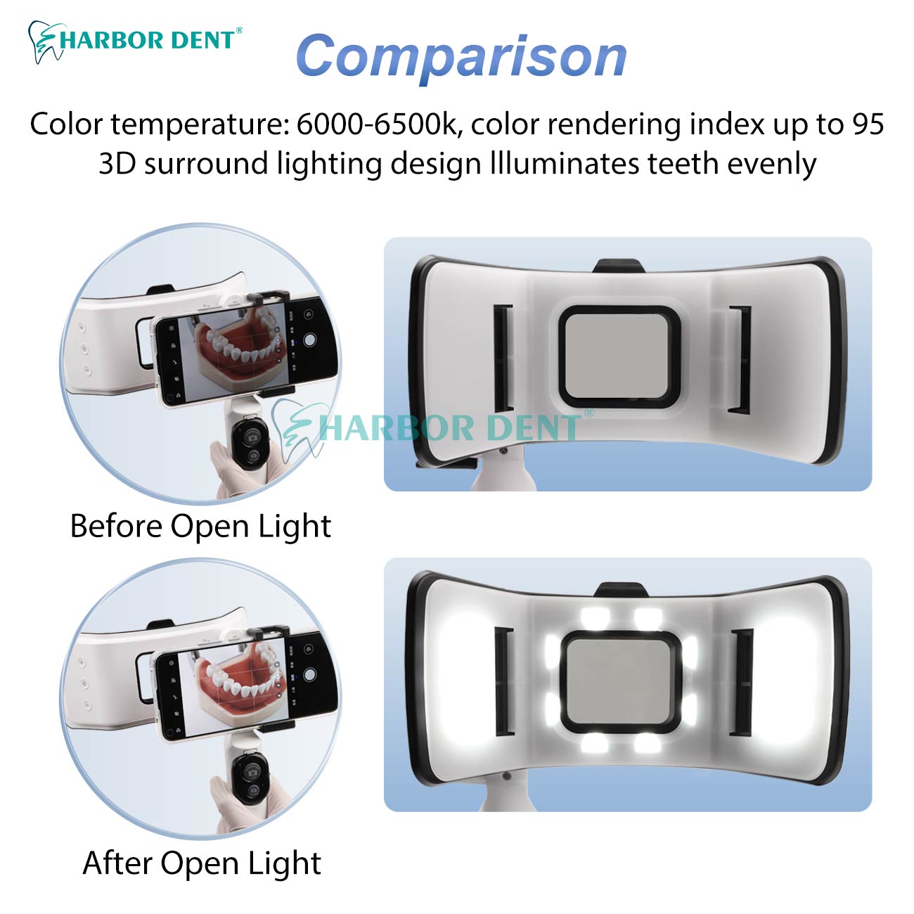 Good Price Dental Photography  - Good Lighting In Photography 评论和价格