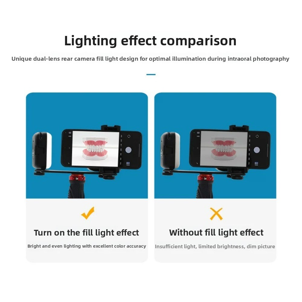 Dental Photography Light, Blue - Photography Lighting Kits 评论和价格